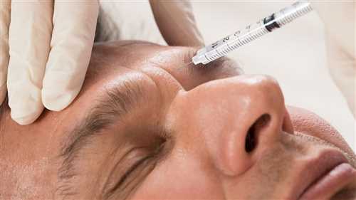 بوتاکس میگرن