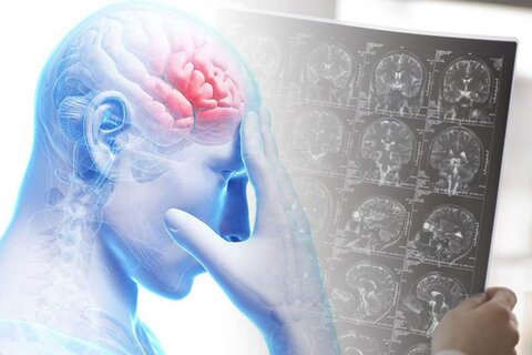تشخیص تومور مغزی در کسری از ثانیه با هوش مصنوعی