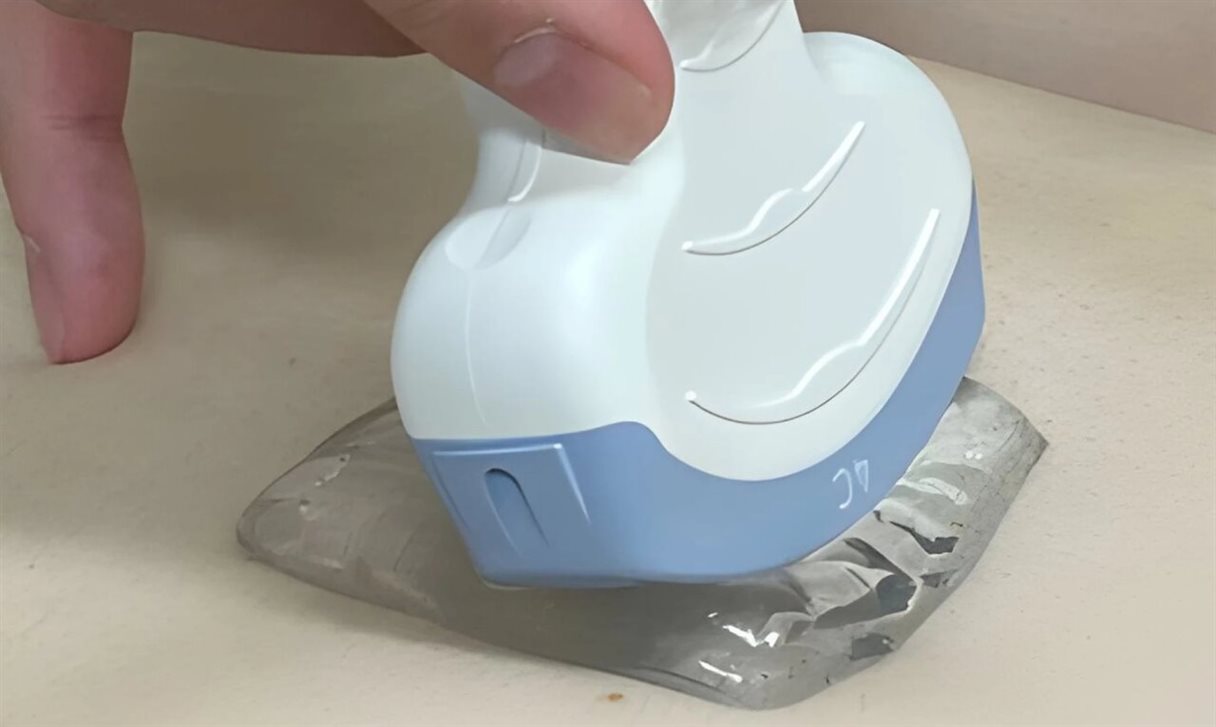 پد سونوگرافی جامد می‌تواند جایگزین ژل‌های مایع رایج در سونوگرافی شود.