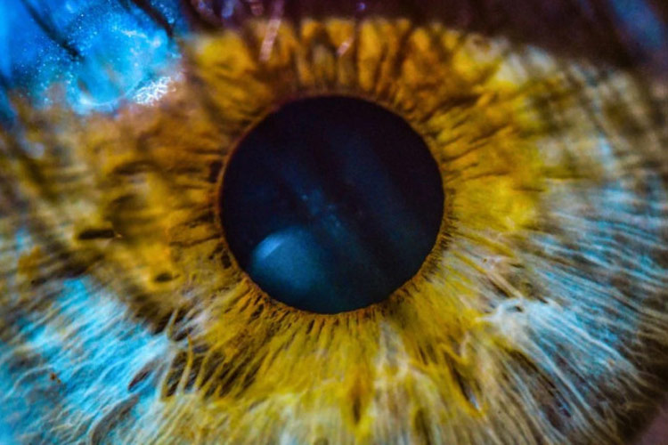 تشخیص بیماری آلزایمر از روی چشم