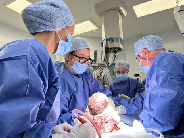 تولد نوزاد با رحم پیوندی