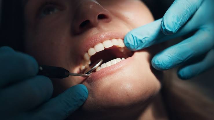 ارتباط خونریزی و بیماری لثه با افزایش خطر آلزایمر و زوال عقل
