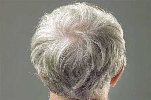 دلایل سفید شدن مو