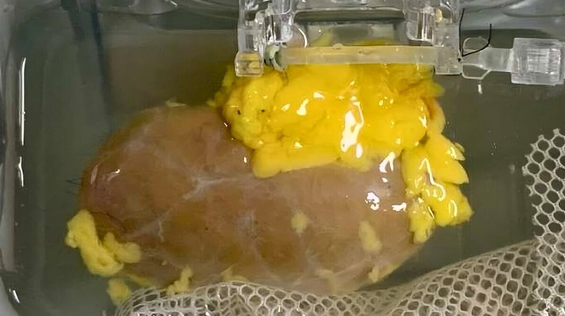 محققان موفق شدند کلیه‌ای آزمایشگاهی تولید کنند که از نظر گروه خونی می‌تواند با اغلب بیماران سازگار باشد.