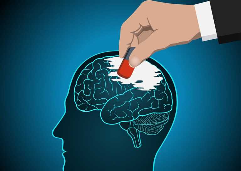 ویرایش خاطرات مغز