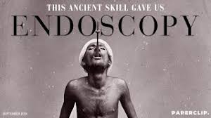 رابطه بلعیدن شمشیر و اندوسکوپی