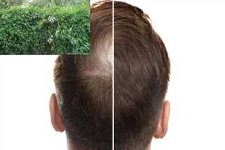 یک پژوهش جدید نشان می‌دهد گیاه «پلی‌گونوم مولتی‌فلوروم»(Polygonum multiflorum) که بیش از ۱۰۰۰ سال در طب سنتی چینی برای مشکی کردن مو و تقویت آن استفاده ‌شده است، می‌تواند جایگزین امیدوارکننده‌ای برای داروهای آلوپسی آندروژنتیک باشد.