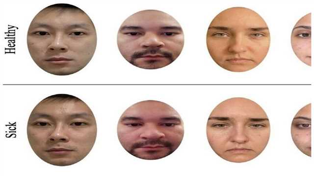 زنان نسبت به مردان توانایی بهتری در شناسایی علائم بیماری دارند