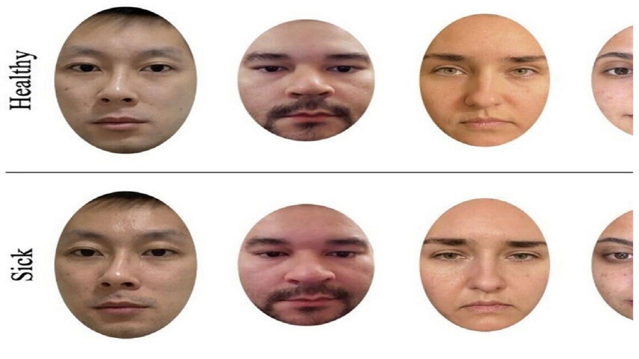 زنان نسبت به مردان توانایی بهتری در شناسایی علائم بیماری دارند